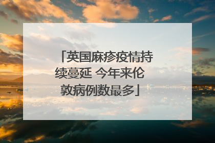 英国麻疹疫情持续蔓延 今年来伦敦病例数最多